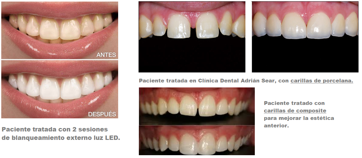 IMPLANTOLOGÍA 5.PNG